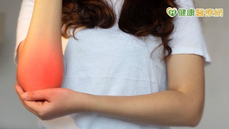 35歲會計師手肘痛3年！竟不是單純網球肘　微創手術助改善