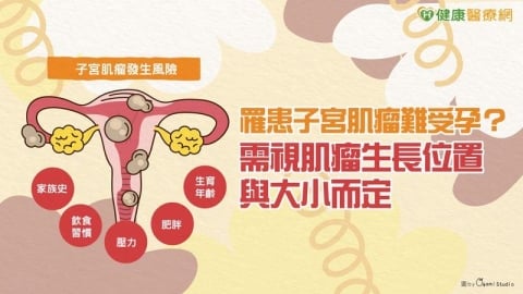 罹患子宮肌瘤難受孕?需視肌瘤生長位置與大小而定
