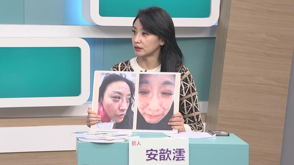 手握外遇鐵證！安歆澐遭夫「勒頸施暴」逼交證據 驚悚過程險喪命