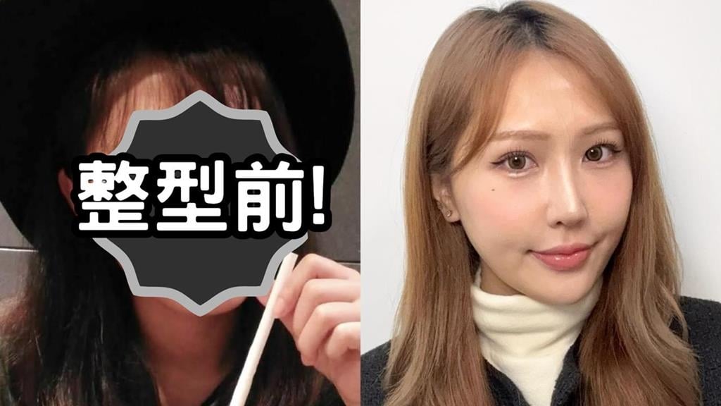 Joeman新女友「醫美前後對比照」流出…本尊霸氣：要說我整形臉都沒差！