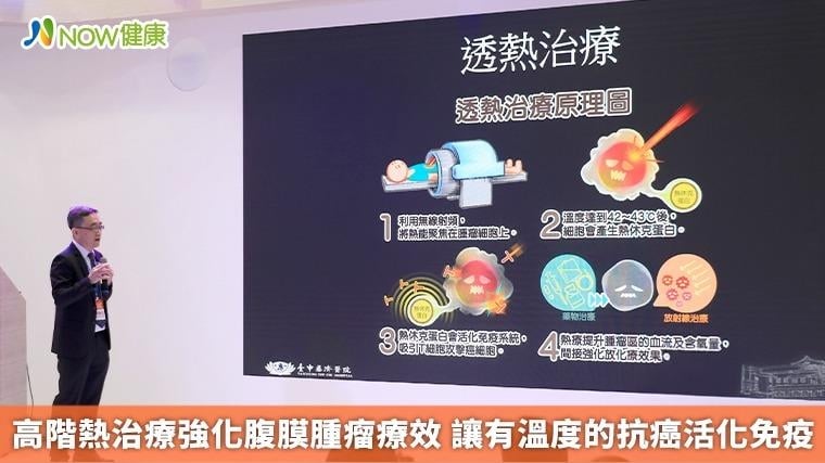 高階熱治療強化腹膜腫瘤療效 讓有溫度的抗癌活化免疫