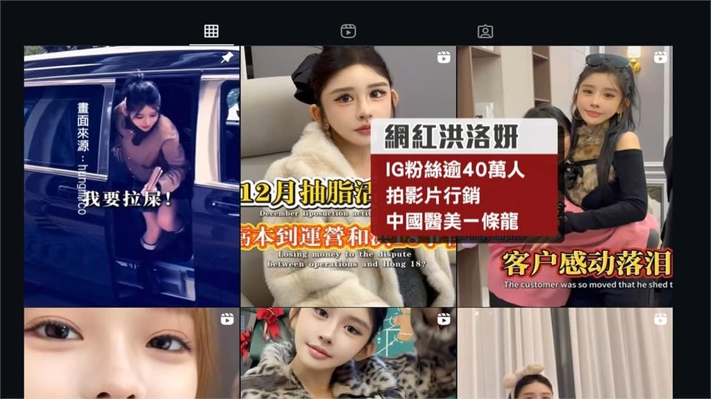 網紅洪洛妍「仲介中國醫美」鬧糾紛！　女花逾11萬元動刀遭毀眼