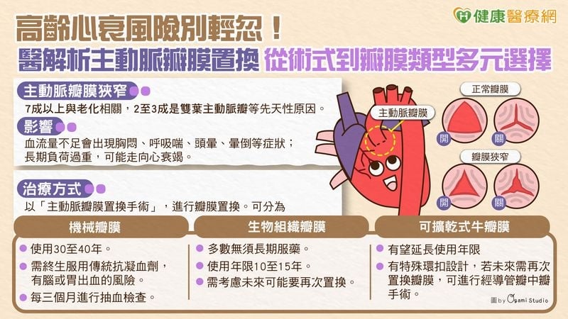 高齡心衰風險別輕忽!醫解析主動脈瓣膜置換 從術式到瓣膜類型多元選擇