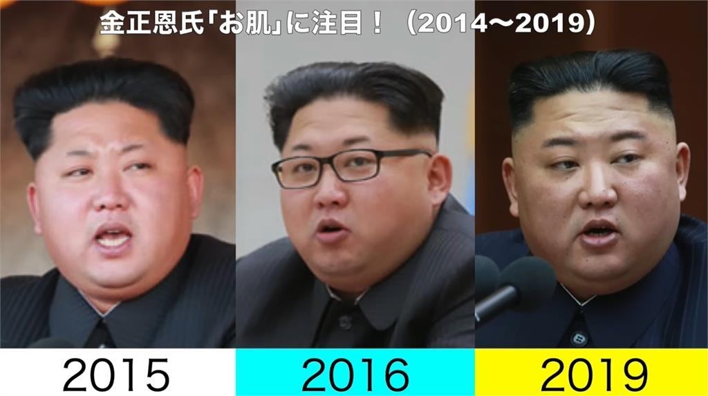 金正恩「無修圖照」爆健康疑雲！臉上長滿「詭異肉芽」10年前對比照曝光