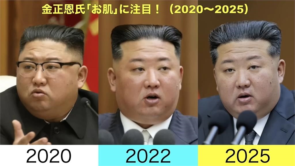 金正恩「無修圖照」爆健康疑雲！臉上長滿「詭異肉芽」10年前對比照曝光