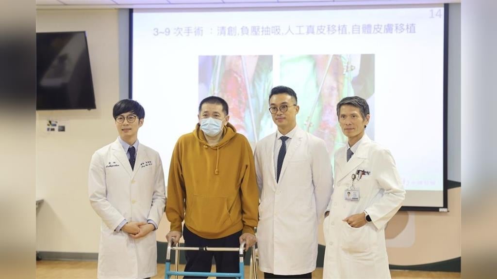 單親爸車禍「雙腳幾截斷…」   新光醫院奇蹟115天成功保肢