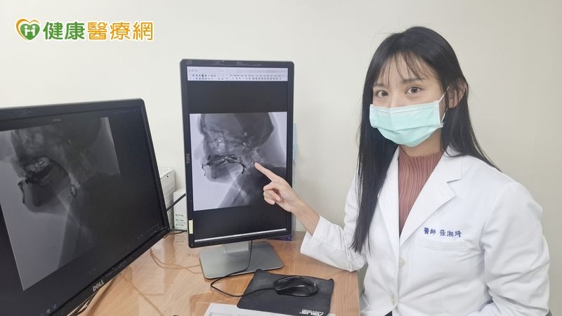 只剩8顆牙進食困難，加「增稠劑」反降食慾　專家教4招訓練吞嚥