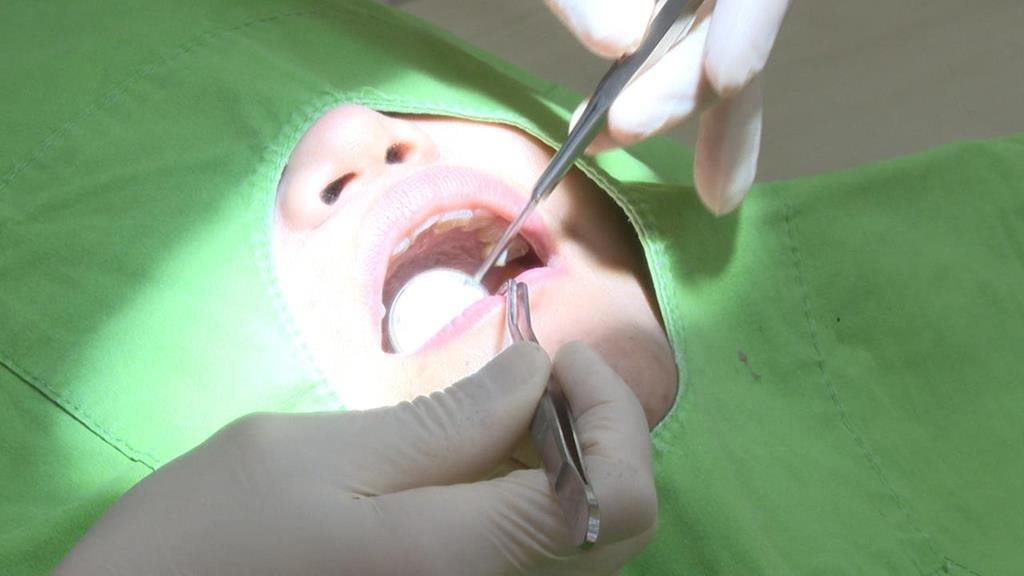 精準植牙時代來臨　「ALL-on-4」植牙十年維持率逾9成