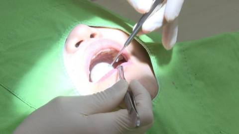 精準植牙時代來臨　「All-on-4」植牙十年維持率逾9成