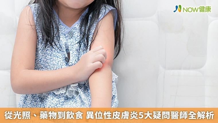 從光照、藥物到飲食 異位性皮膚炎5大疑問醫師全解析