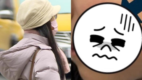 冬天臉頰泛紅「像被打巴掌」竟不是過敏!醫籲「蘋果病」症狀:易被忽略