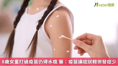 8歲女童打過疫苗仍得水痘 醫:疫苗讓症狀輕併發症少