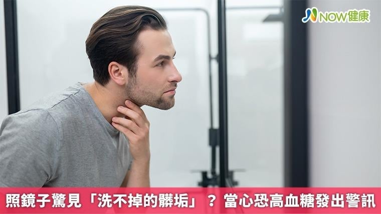 照鏡子驚見「洗不掉的髒垢」？ 當心恐高血糖發出警訊