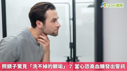 照鏡子驚見「洗不掉的髒垢」? 當心恐高血糖發出警訊