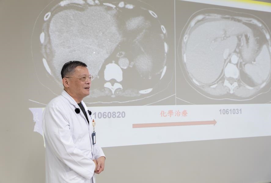 奇蹟!婦人「數百顆腫瘤」兩個月全消 陽交大醫院逆轉生機