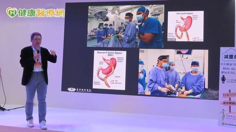 男胖到135公斤陷換心危機　「這樣做」成功助病態肥胖者逆轉心衰危機