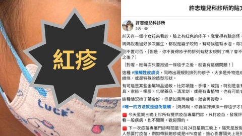 女童臉上驚見「紅疹排排站」誤當被蟲咬　醫曝「這1物」惹的禍：換掉才會好！