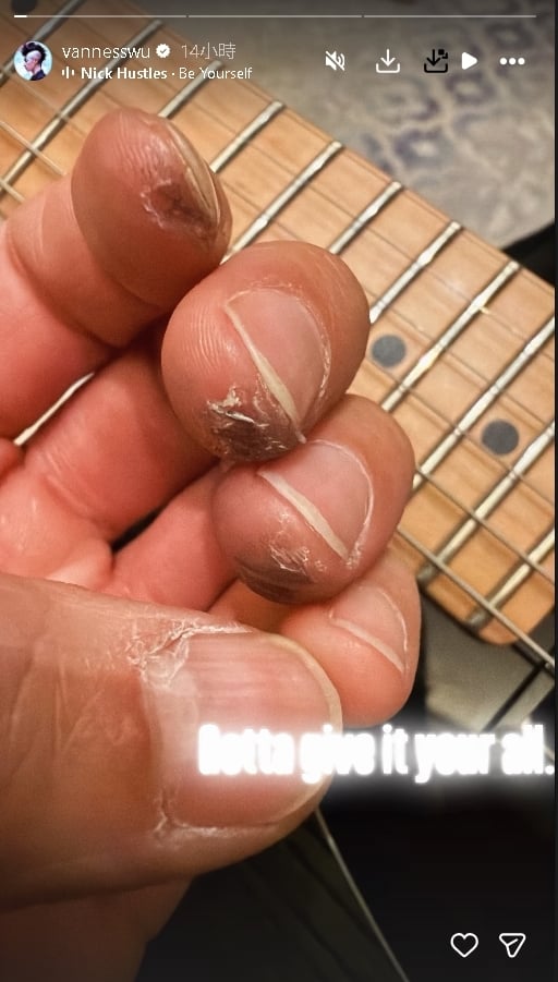 才傳暴瘦20公斤脫相！吳建豪再曬「手指傷勢照」粉絲嚇壞…周杰倫出手了