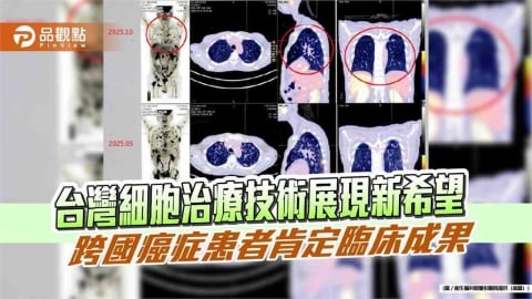 台灣細胞治療技術展現新希望　跨國癌症患者肯定臨床成果