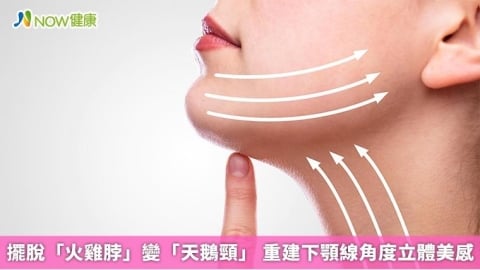 擺脫「火雞脖」變「天鵝頸」 重建下顎線角度立體美感