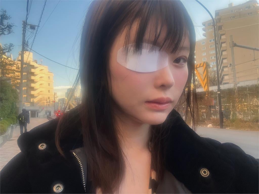 AV女神慘被牛郎前男友打成「獨眼龍」!昔「月燒千萬、斷連友人」心酸內幕曝