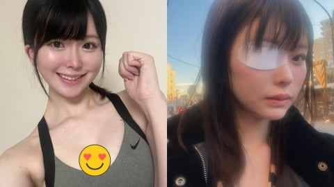 日女優慘變「獨眼龍」心酸內幕曝!昔為牛郎前男友「月燒千萬、斷聯友人」