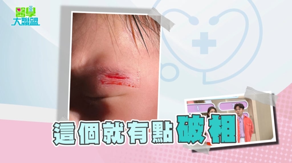 潘逸安《醫學大聯盟》育兒急診血淚史:三歲童連撕傷口裂開狂噴1.5萬元