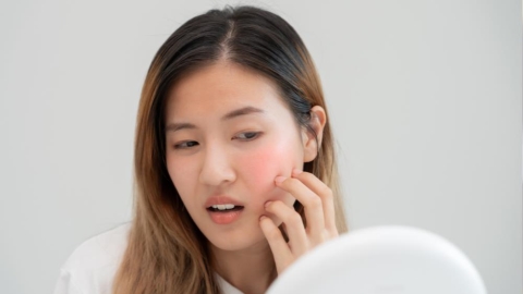 臉部反覆發紅發癢？常見肌膚不適原因之一可能與濕疹相關