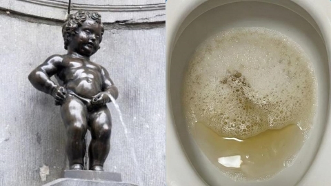 男一早尿尿「啤酒泡沫」以為是腎病！檢查竟發現「小蝌蚪」醫揭背後警訊