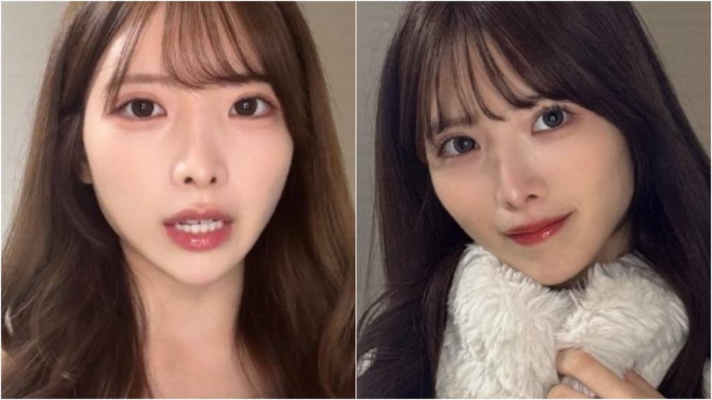 日本前女團成員「狠砸百萬整形」變超級正妹…無預警曬5年前「驚人對比照」！