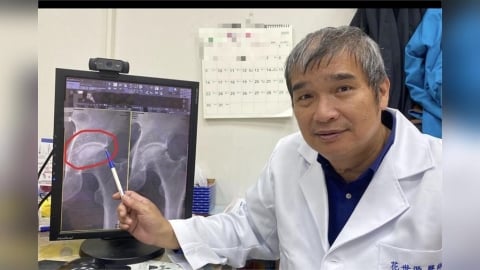 走路沒事「一蹲就痛」？   長時間深蹲小心髖關節夾擊症候群