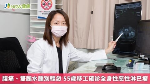腹痛、雙腿水腫別輕忽 55歲移工確診全身性惡性淋巴瘤