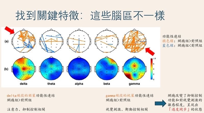 人手一機更易陷網路成癮　國衛院用「腦波」結合AI揪出早期警訊！