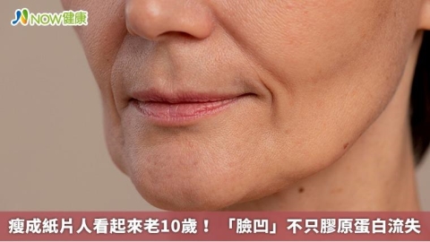 瘦成紙片人看起來老10歲！ 「臉凹」不只膠原蛋白流失