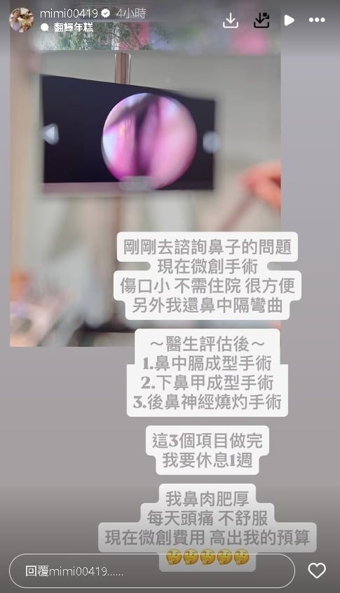 米可白「1器官出事」狂流鼻血、頭痛！醫建議「一次動3手術」她猶豫了…