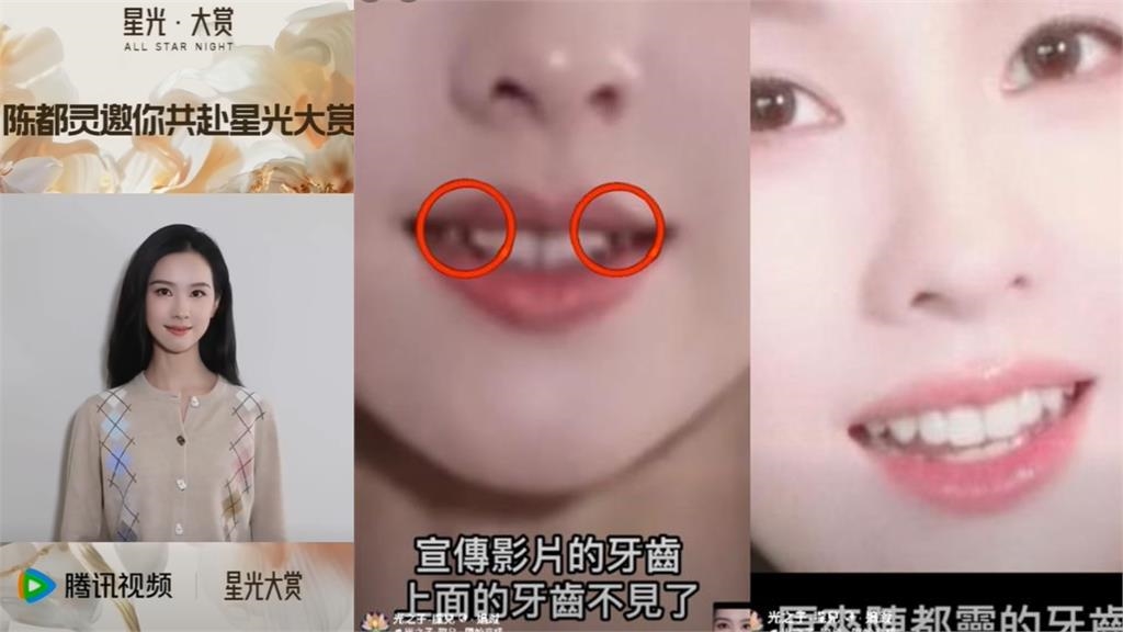 陳都靈爆「臉遭燒、被獻祭」牙齒消失
