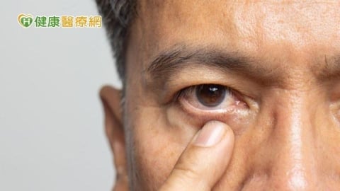 為何青光眼一定要控眼壓？醫解析「青光眼導流支架」微創手術新選擇！