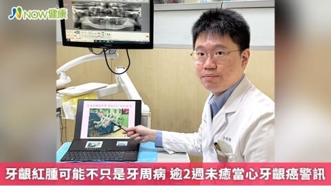 牙齦紅腫可能不只是牙周病 逾2週未癒當心牙齦癌警訊