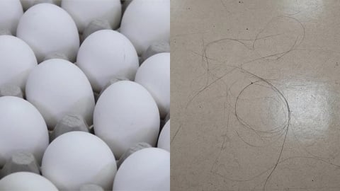 中國煮蛋網紅自曝5年「日嗑40顆雞蛋」！營養師示警：「1情況」恐大量掉髮