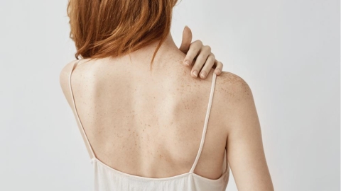 背部痘痘反覆出現？專家整理 4 大可能因素與日常照護原則