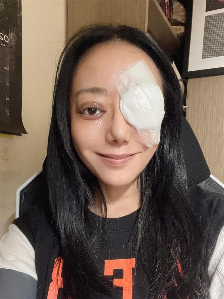  高慧君差點失明！「3次開刀」後曬自拍揭「大小眼現況」：剩最後一次了