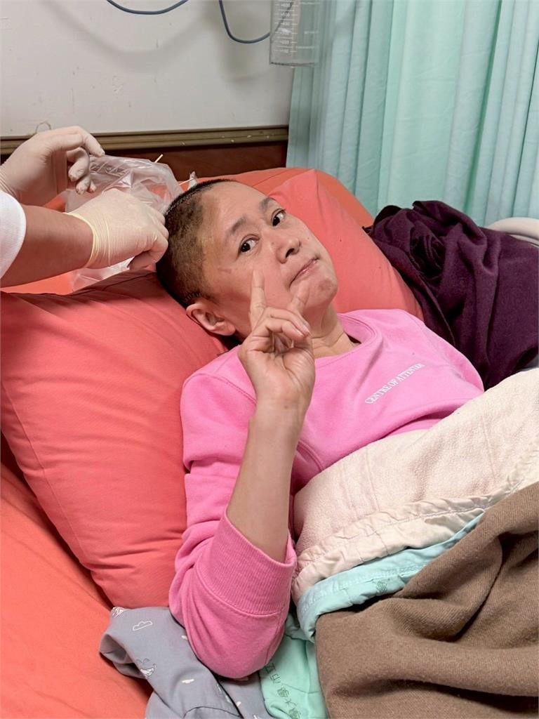 王月爆「跌倒昏迷」緊急動開顱！兒簽放棄急救同意書…再動刀吐「最大遺願」