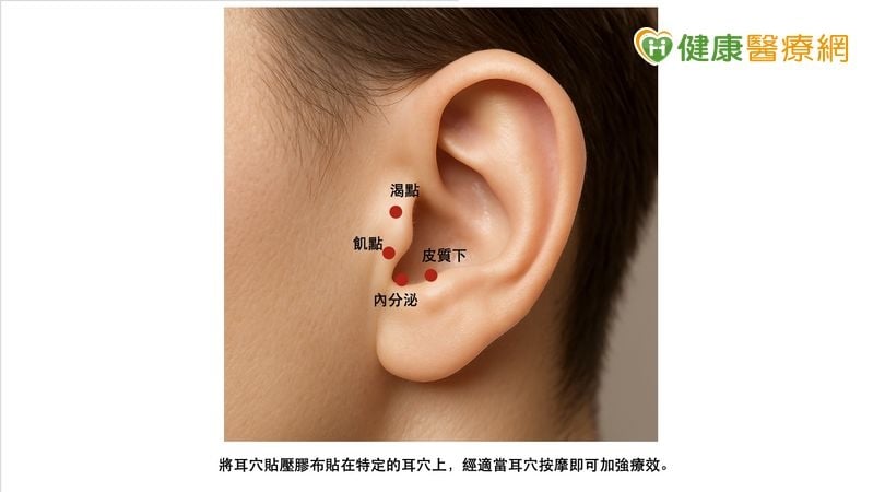 吃藥血糖還是高？中醫調理輔助控糖　耳穴保健也能幫忙