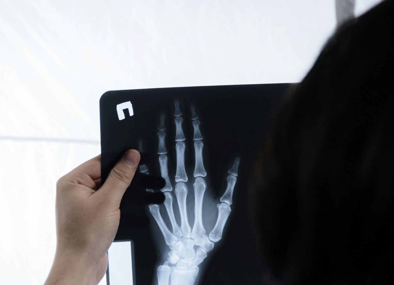 吸菸或曝露二手菸「傷骨」 衛福部警告：提高骨折、骨鬆風險 8