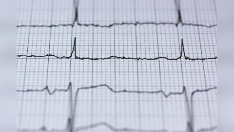 吃飽「一陣冷風吹來」頭暈、噁心 她竟心房顫動短暫性中風!