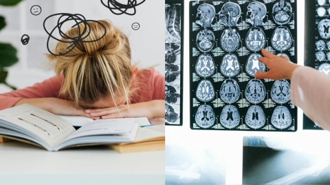 失智與「人格特質」有關？專家點名「這類人」壓力爆棚恐增老化風險