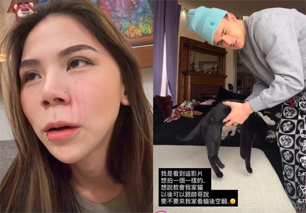 蕾菈遭突襲「半張臉被抓傷」險毀容！竟是「1片段惹事」驚悚過程曝：好扯…