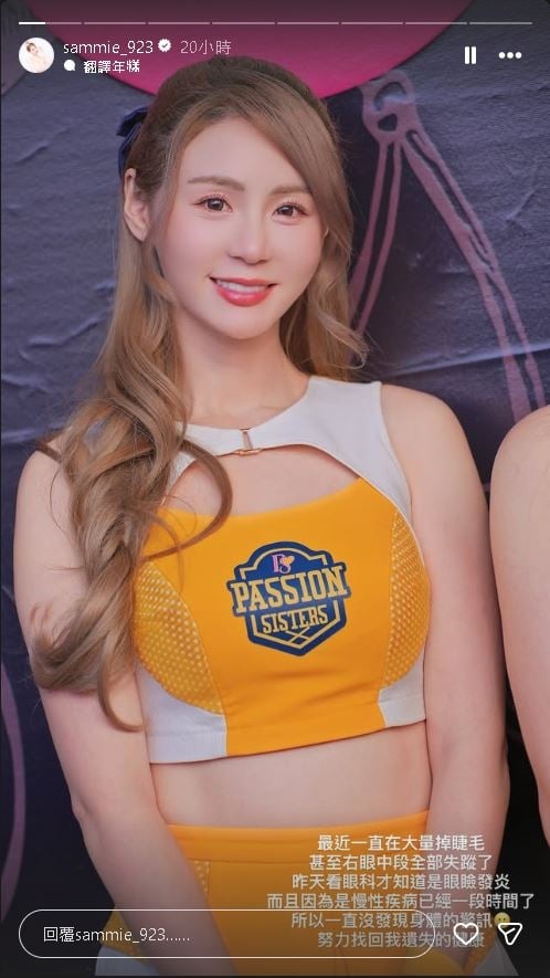 PS女孩短今自曝「右眼睫毛狂掉」!診斷後竟是1慢性疾病纏身