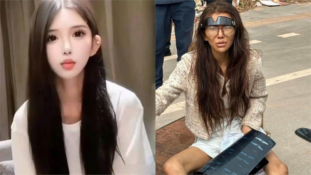 20多歲超正網紅遭斷腿丟柬埔寨　昔自曝「詐團高層女友」被挖網驚：太炸裂了！