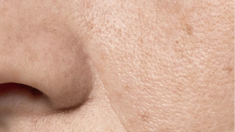 毛孔粗大怎麼看?4 大常見 NG 習慣與日常保養調整方向